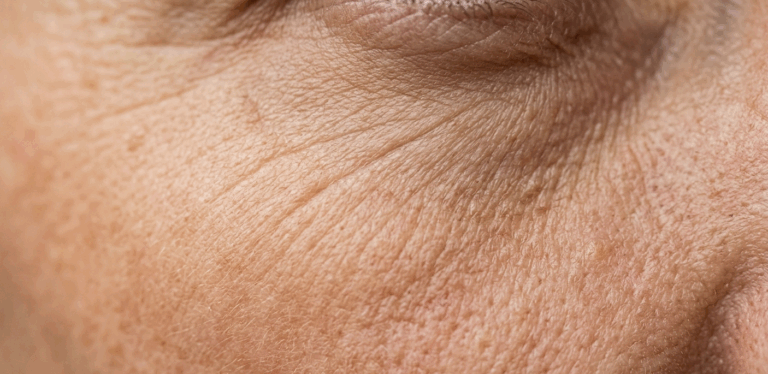 idratazione cutanea