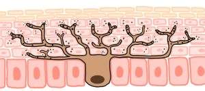 melanogenesi - melanocita