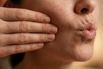 face yoga ginnastica facciale